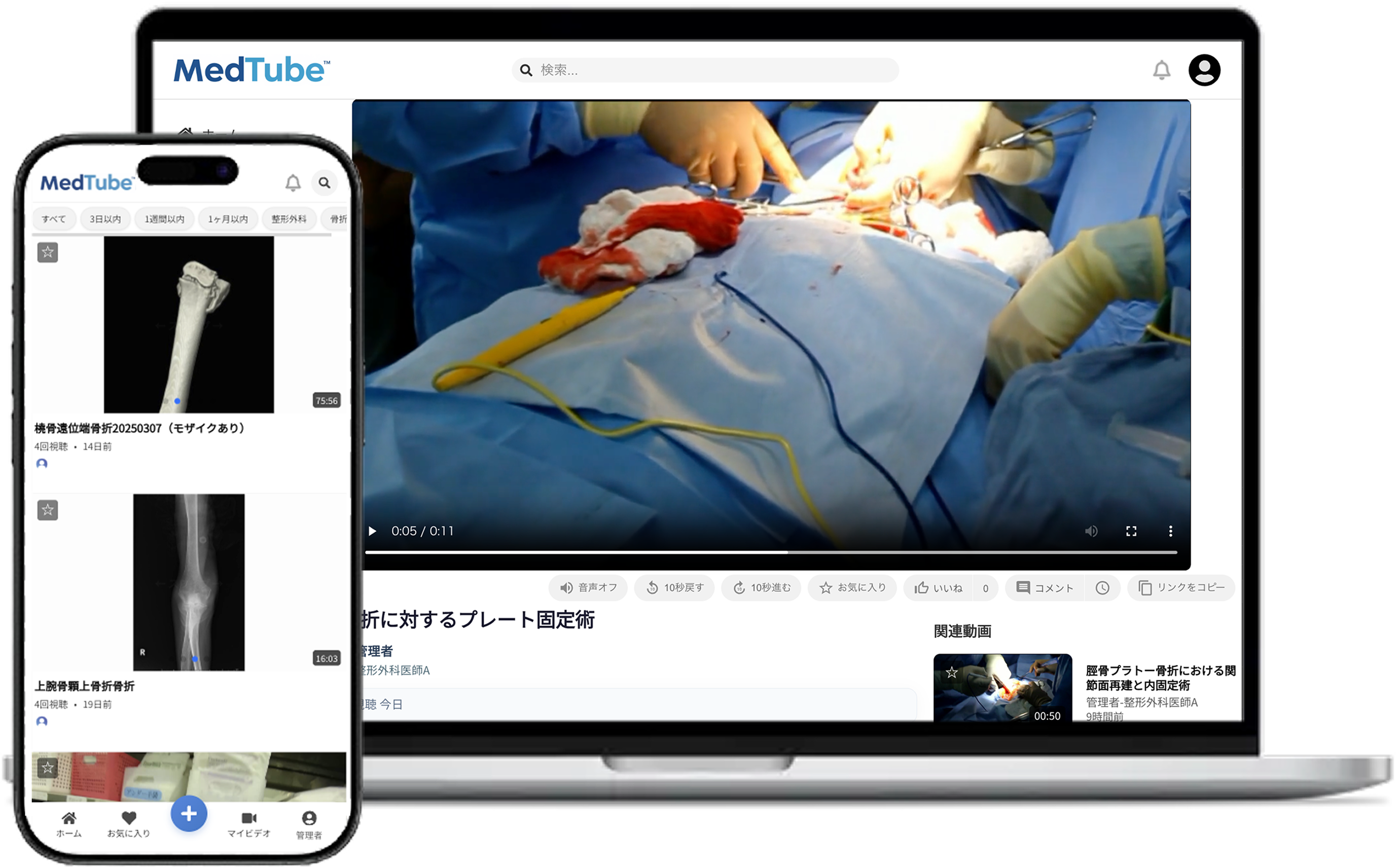 MedTube 正式リリースのお知らせ